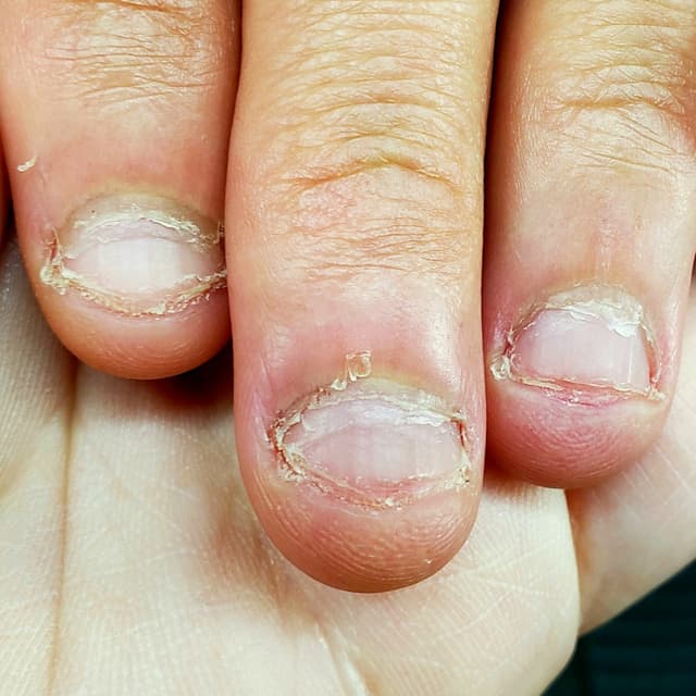 Claw Rehab at Rebellious Nails in Seattle, WA